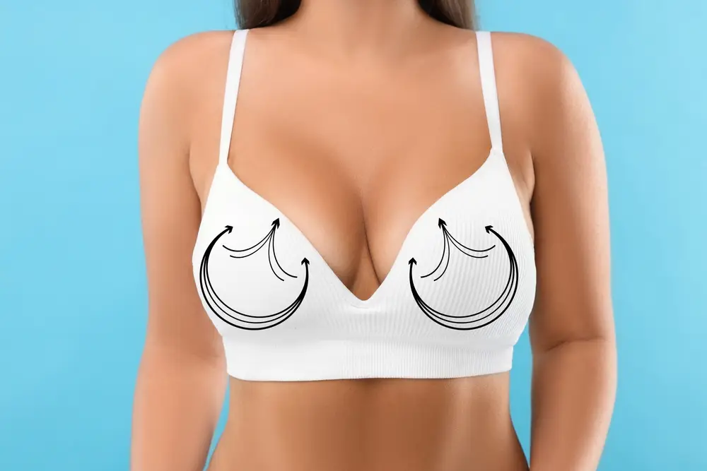 Breast Uplift or Reduction