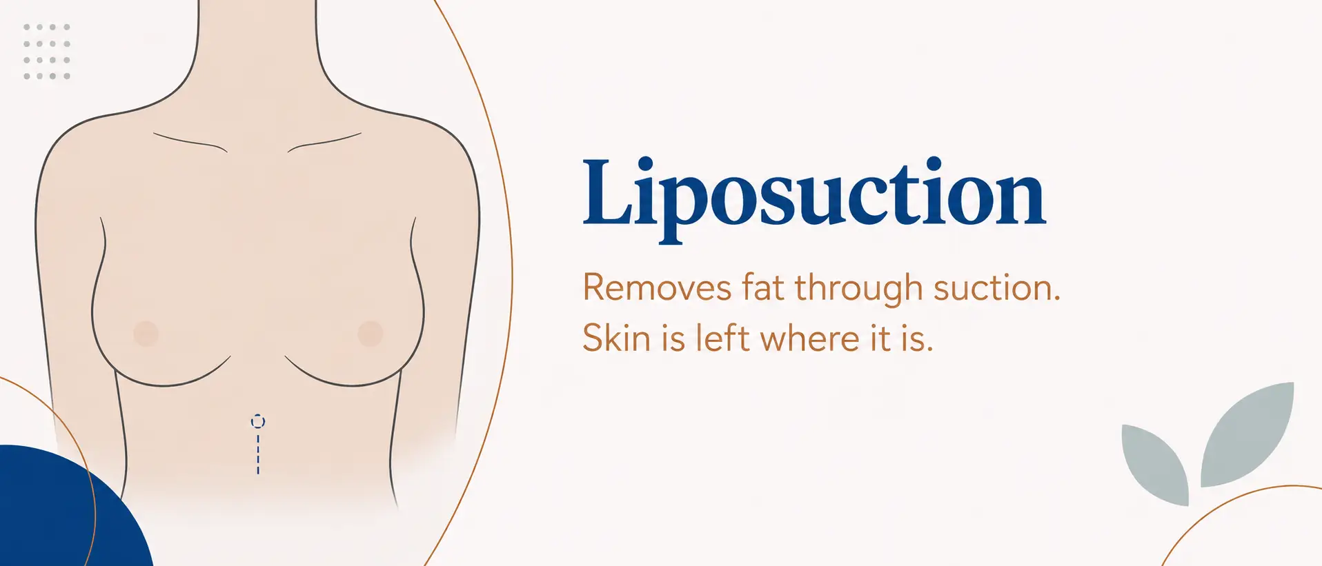 Liposuction