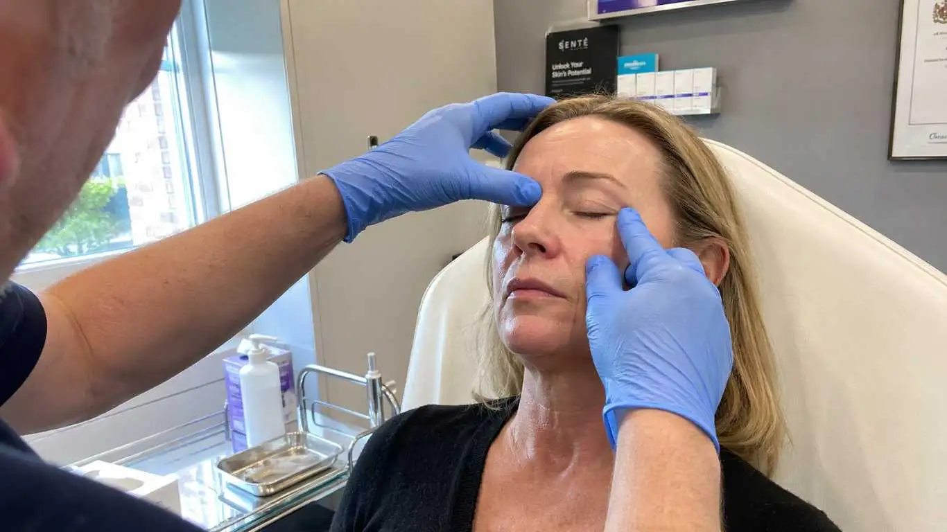 Upper Eyelid Blepharoplasty